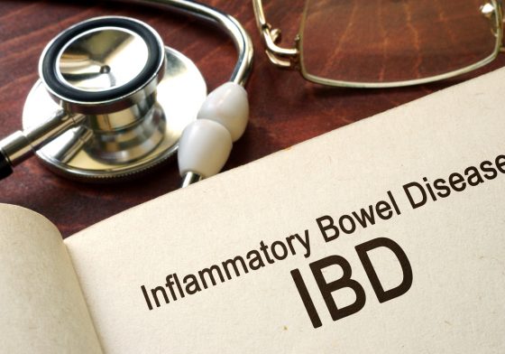 Inflammatory Bowel Disease Tips