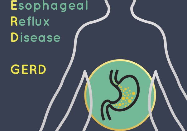 Gastro Esophageal Reflux Disease (GERD) illustration of human body with focus on the stomach