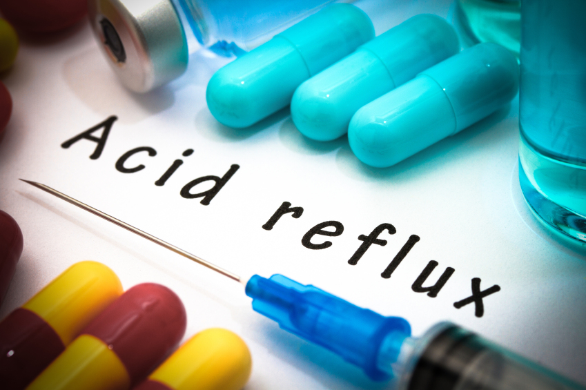 Update on acid reflux medications Capital Digestive Care